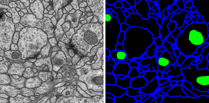 <b>Figure 1.</b> Membrane segmentation by deep learning prediction with a Unet model trained with the Avizo software.