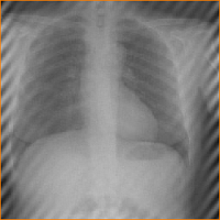 Figure 3: A noisy image