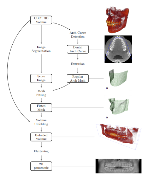 <b>Figure 1.</b> Overview of the dental panoramic extraction